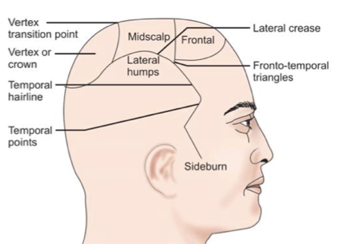 Hair Loss Glossary - Regrowth. Your Source Of Hair News